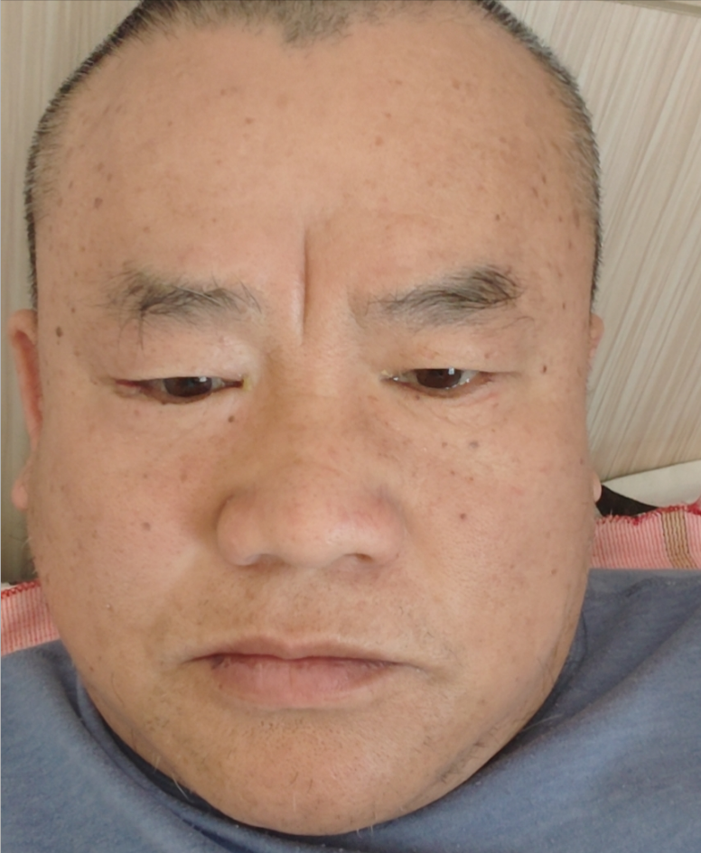 全勇